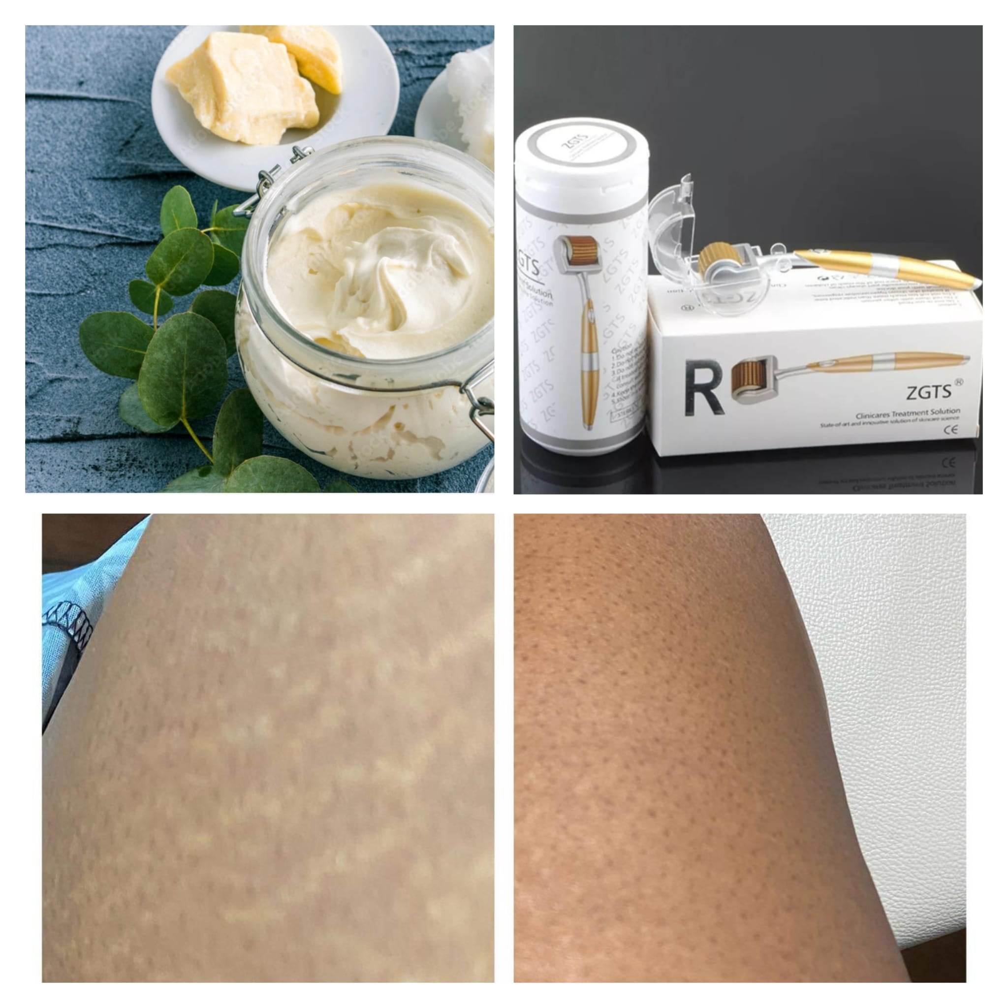 Riyah Stone Stretch Mark Body Butter Kit